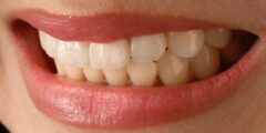 5 أسرار لضبط النفس