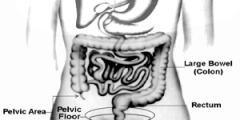 Dyssynergic Defecation: حول سبب مشترك للإمساك المزمن