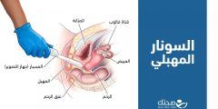 السونار المهبلي.. ما غرض هذا الإجراء وكيف يتم؟