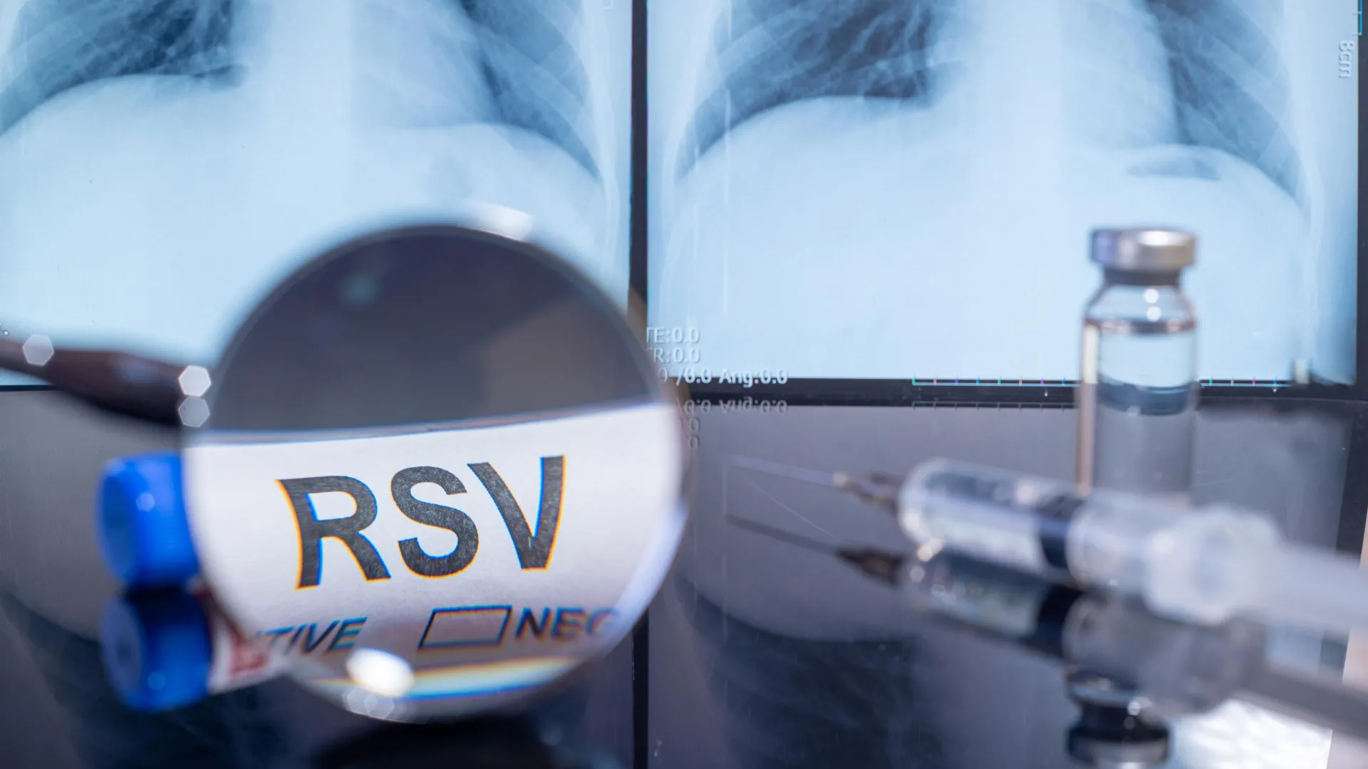 طلقة الحمل واحدة تقطع المستشفى RSV Baby بنسبة 72 ٪ - والدروع لعدة أشهر