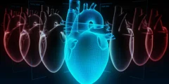 منظمة العفو الدولية بقع مخاطر القلب القاتلة لا يستطيع معظم الأطباء رؤيتها