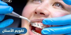 هل يمكن للبالغين الحصول على تقويم الأسنان ؟