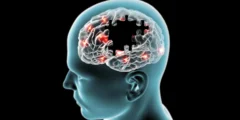 قد ترفع ليالي بلا نوم خطر الخرف بنسبة 40 ٪ ، كما تكشف Mayo Clinic