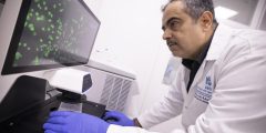 تطورات الذكاء الاصطناعي في تشخيص سرطان الثدي وعلاجه