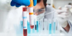 يؤكد اختبار الدم الاختراقي أخيرًا متلازمة التعب المزمن