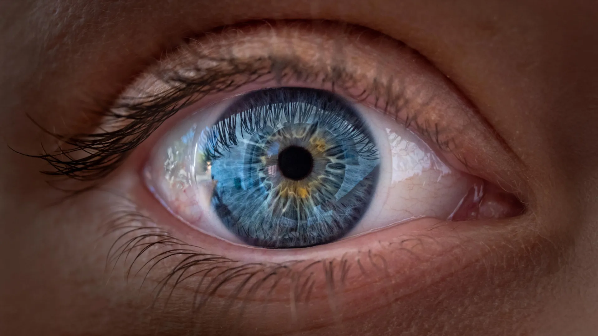 يساعد العلاج بالخلايا الجذعية مرضى AMD على الرؤية مرة أخرى