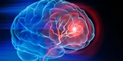 يُظهر دماغك ضررًا قبل أن يرتفع ضغط دمك