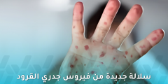 ظهور سلالة جديدة من فيروس جدري القرود في المملكة المتحدة والهند
