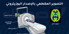ما هو التصوير المقطعي بالإصدار البوزيتروني وما استخداماته؟