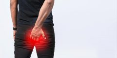 أحدث التوصيات الطبية بشأن تشخيص وعلاج البواسير