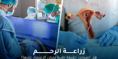 هل أصبحت زراعة الرحم حقيقة طبية يمكن الاعتماد عليها؟