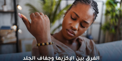 الفرق بين الإكزيما وجفاف الجلد:كيف تميز بينهما وما العلاج؟