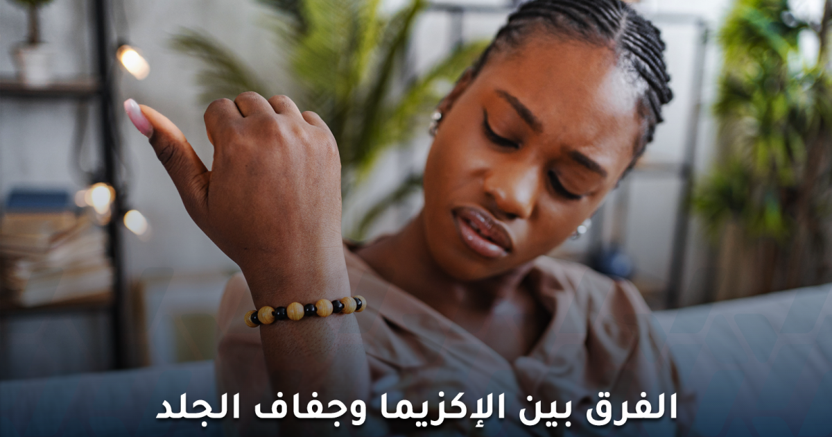 الفرق بين الإكزيما وجفاف الجلد:كيف تميز بينهما وما العلاج؟
