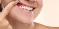 هل يمكن للصيام أن يحارب أمراض اللثة؟ يجد العلماء رابطًا مدهشًا