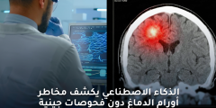 الذكاء الاصطناعي يكشف مخاطر أورام الدماغ دون فحص جيني