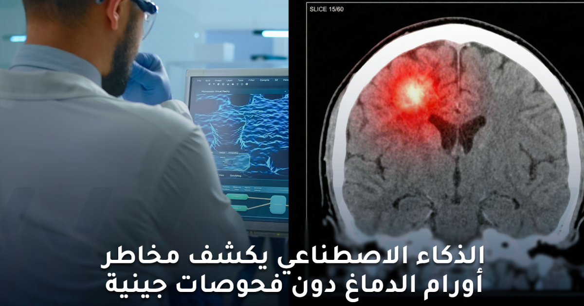 الذكاء الاصطناعي يكشف مخاطر أورام الدماغ دون فحص جيني