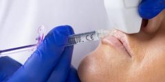 الموجات فوق الصوتية تقلل مخاطر الفيلر وتحمي من المضاعفات