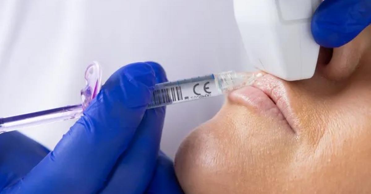 الموجات فوق الصوتية تقلل مخاطر الفيلر وتحمي من المضاعفات