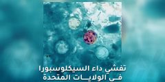 تفشي داء السيكلوسبورا في الولايات المتحدة ومصدر العدوى مجهول