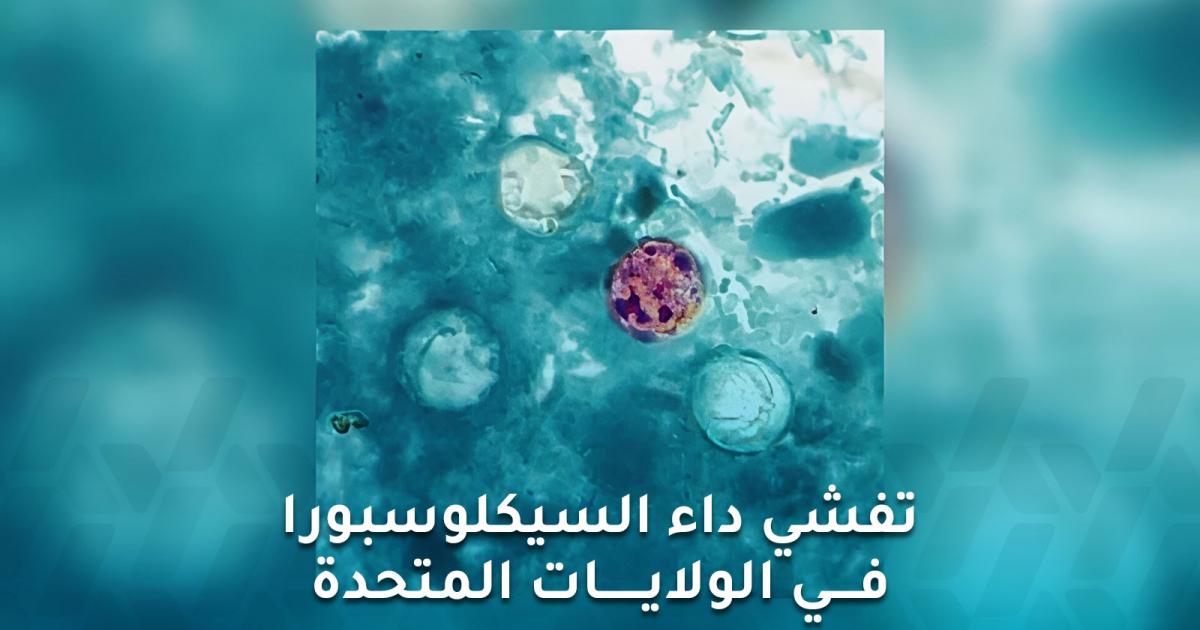 تفشي داء السيكلوسبورا في الولايات المتحدة ومصدر العدوى مجهول