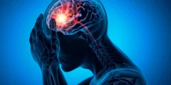 ربما تم إغفال السبب الحقيقي للسكتة الدماغية الشائعة لعقود من الزمن