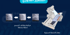 ما هو التنظير الفلوري وما الغرض منه وما طريقة إجرائه؟