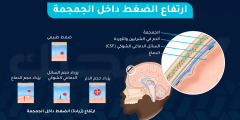 هل ارتفاع الضغط داخل الجمجمة حالة طبية خطيرة تحتاج تدخلًا؟